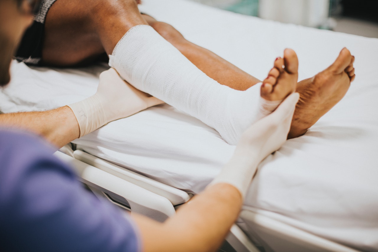 Doctor wearing surgical gloves treating patient with broken leg